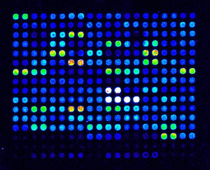 DNA mikroarray. Foto: Dreamstime