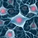 Kan genterapi hjälpa mot Parkinsons?