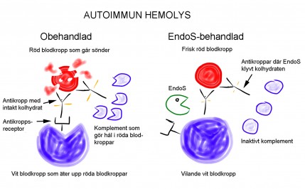 Autoimmun hemolys
