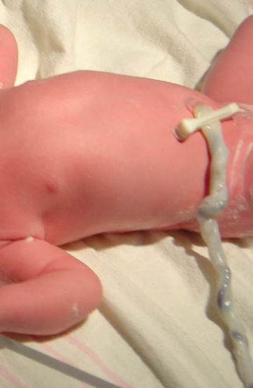 nyfödd med navelsträng