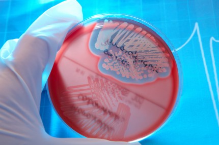 Resistenta bakterier med hem från utlandsresan