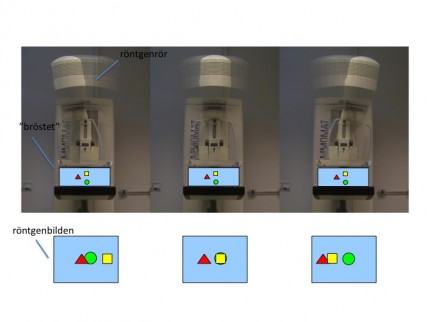 Illustration av en tomosyntesundersökning