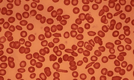 Blodceller sett genom ett mikroskop