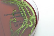 Escherichia coli kolonier på en odlingsplatta