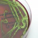 Antibiotikaresistenta bakterier fortsatt hot mot hälsan