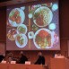 Kost och diabetes – vad är bäst att äta och varför?