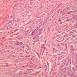 Forskningsprojekt för bättre cancerbehandling