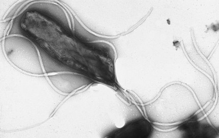 Heliobacter pylori med flageller