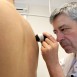 Fler melanompatienter – men inte fler dödsfall
