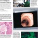 En resa i bilder in i lungans innersta delar