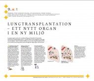 Lungtransplantation - ett nytt organ i en ny miljö