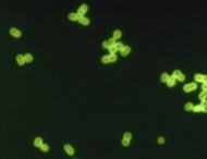 Pneumokocker (Streptococcus pneumoniae)