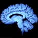 Alzheimersskador kan ses tio år före sjukdomsdiagnos
