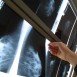Mammografiscreening av bröstcancer hos överviktiga kvinnor