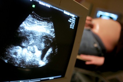 bild på foster med ultraljud