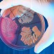 Globala resvanor ökar spridning av antibiotikaresistens