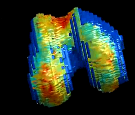 3D-bild över knäleden