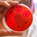 Antibiotika – missbrukad mirakelmedicin