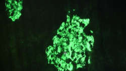Bilden visar en langerhansk ö med betaceller 