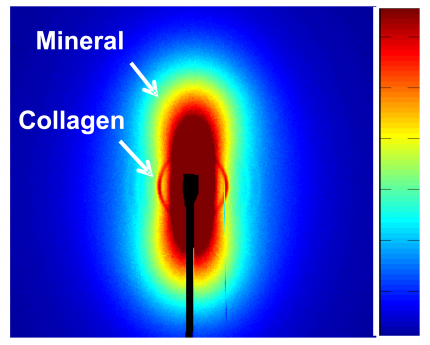 mineralstruktur i ett ben