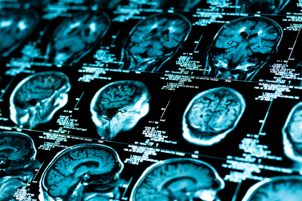 Sharp ct scan image of the human brain
