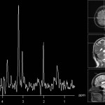 spectroscopy