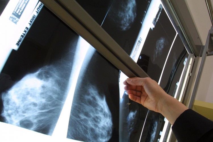 ©PHOTOPQR/LE TELEGRAMME/FRANCOIS DESTOC ; ILLUSTRATION sur la Mammographie. Cancer du sein.