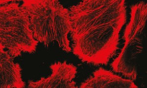 Forskning om att minska cancercellers rörelseförmåga