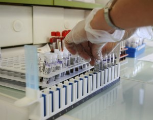 Enkelt blodprov upptäcker försämrad njurfunktion