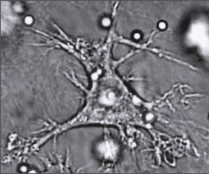 Dendritcellerna – viktiga för vår tarmhälsa