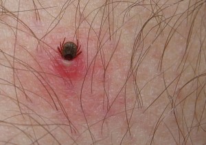 Studier om behandling vid borrelia granskade