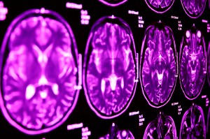 Otroliga datamängder i nya medicinska bilder