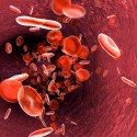 Så kan skadade röda blodkroppar driva kraftig inflammation