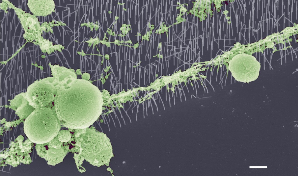 Kan nanoimplantat rädda synen?