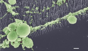 Kan nanoimplantat rädda synen?