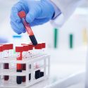 Bättre vård för personer med sällsynta diagnoser