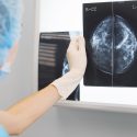 ”Digitala bröst” kan ge skjuts åt bröstcancerscreening