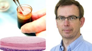 ”Blodplåster” läker svåra fotsår hos diabetespatienter
