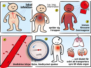 Vad är sepsis?