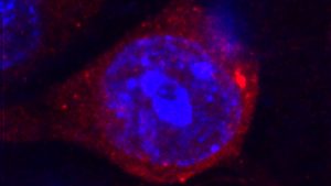 Aktivering av gamla virus orsakar inflammation senare i livet