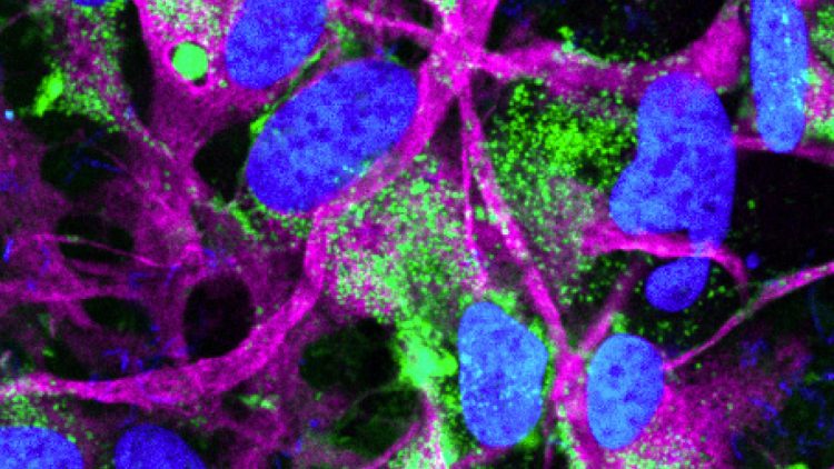 Bilden är en mikroskopibils av astrocyter där olika celler har färgats med blått, lila och grönt. För en oinsatt ser bilden ut som modern konst med starka färger