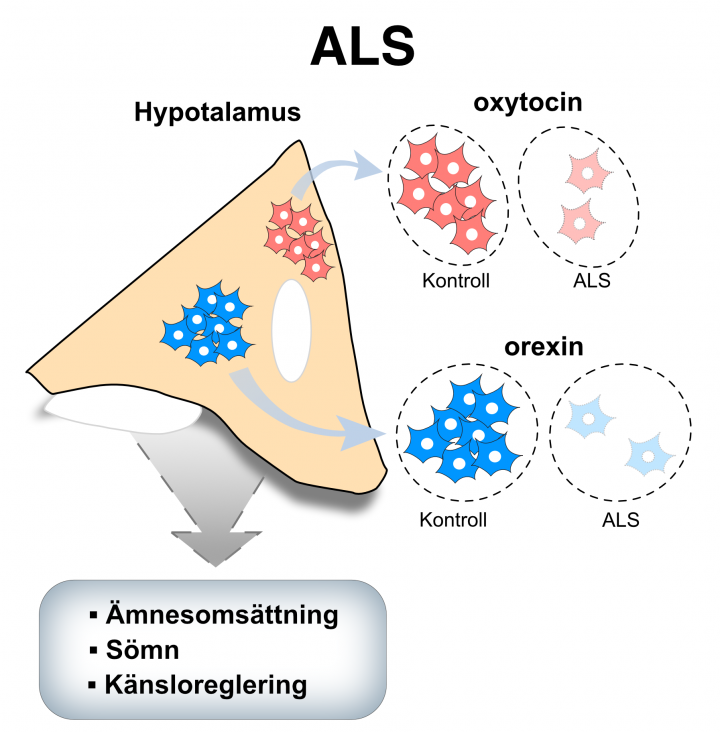 bilden är en schematisk illustration av bildtexten och illustrerar att mängden oxytocin och orexin är minskad hos individer med ALS