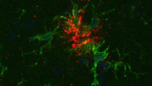 Ny studie på möss om ECT och Alzheimers-protein