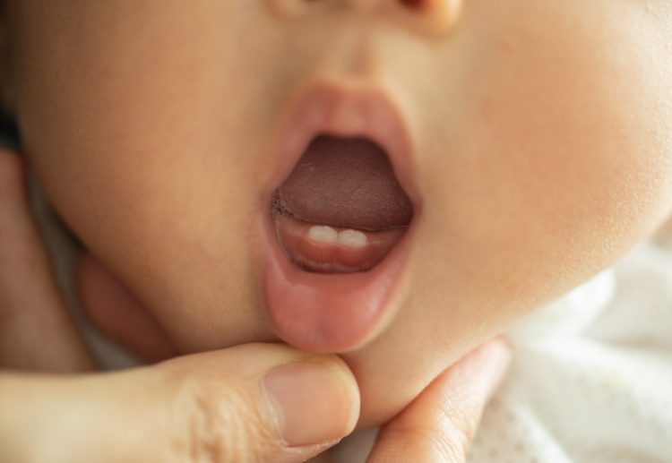 Bild på ett litet barn som fått sina första tänder.