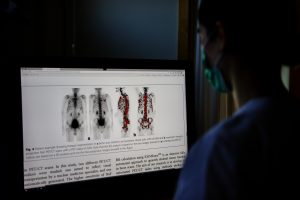 AI – en hjälpreda som spårar metastaser