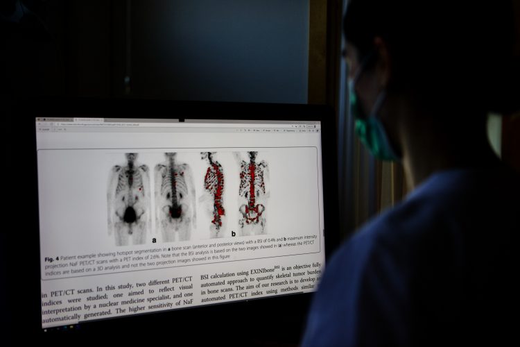 Bild på datorskärm med röntgenbilder av människa med med många metastaser på skelettet.
