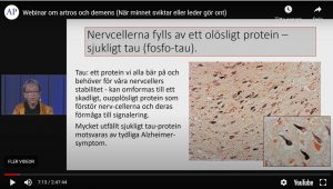 Webbseminarium om artros och demens