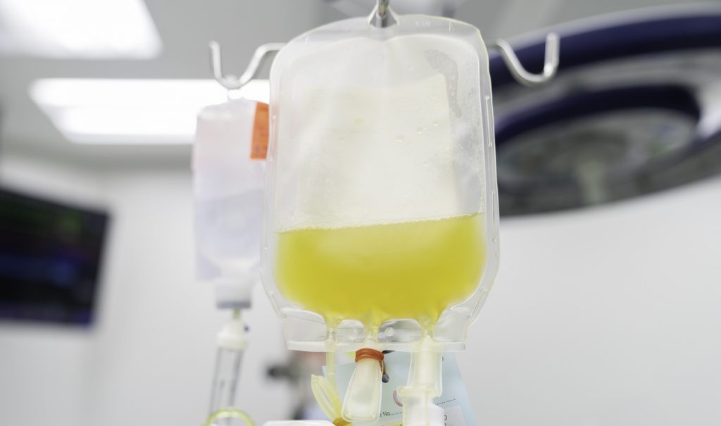 Studie om blodplasma vid covid-19 avbröts i förtid – inga säkra fördelar för patienter på sjukhus