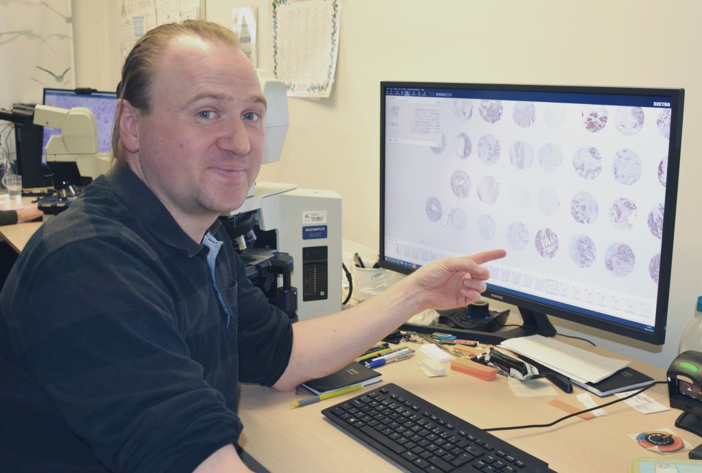 Ny forskning ger bättre diagnostik vid lungcancer