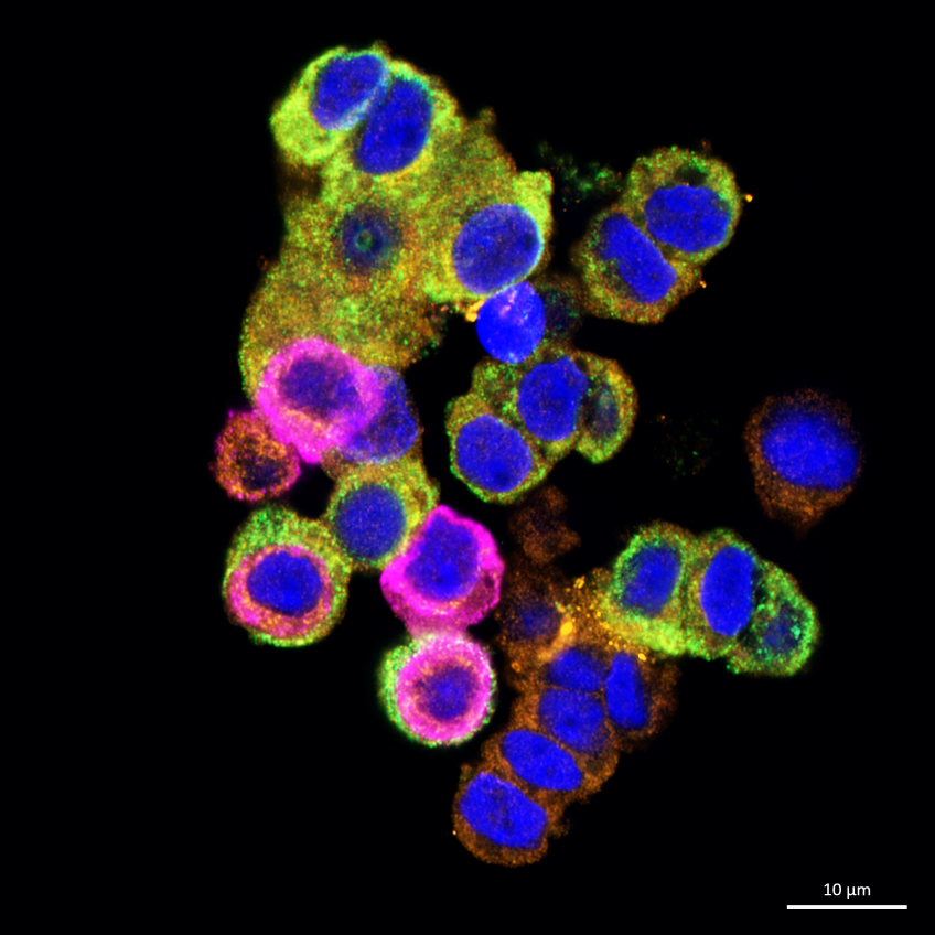 Mikroskopibild av celler, färgade i blått, cerise och gröt mot en svart bakgrund